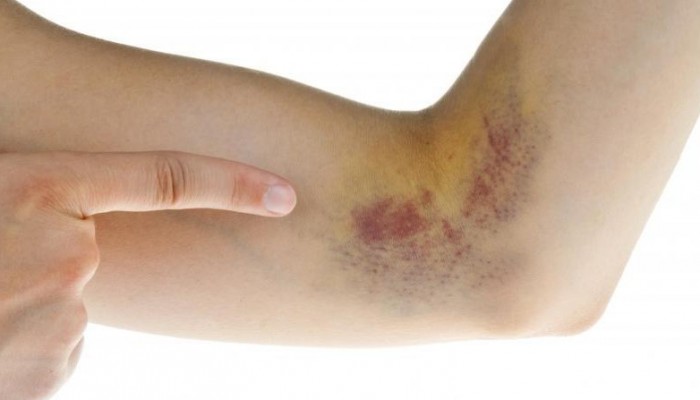 TAN BẦM TÍM HIỆU QUẢ