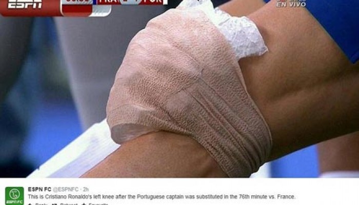 Tất cả về đau khớp gối (P5)