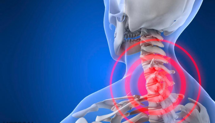 Phương pháp điều trị đau vai gáy cổ